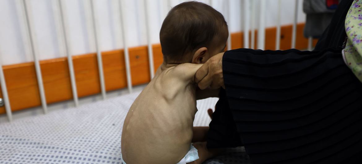 Gazze'de Açlık Krizinin Derinleşen Boyutları